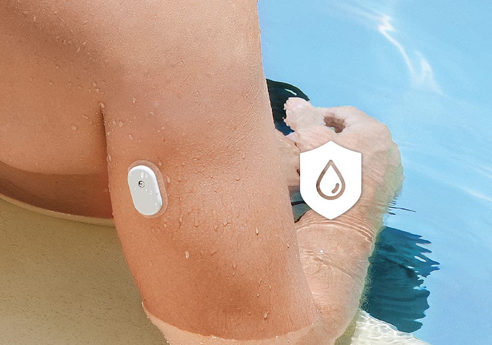 SIBIONICS GS1 CGM